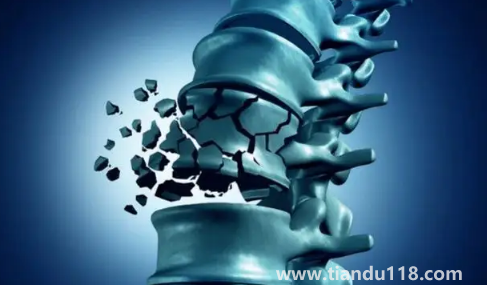 骨質(zhì)疏松癥也叫靜悄悄的流行病（骨質(zhì)疏松吃什么食物可以改善）