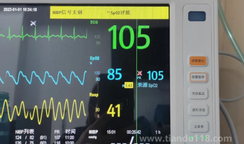 血氧飽和度一直在85行嗎（血氧瞬間80然后馬上恢復正常要緊嗎）