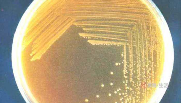 細菌菌落和真菌菌落的區(qū)別是什么